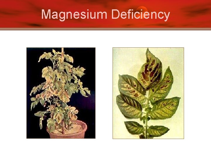 Magnesium Deficiency 