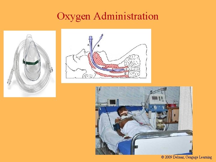 Oxygen Administration © 2009 Delmar, Cengage Learning 