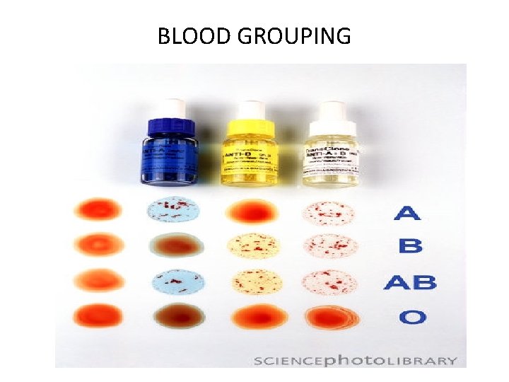 BLOOD GROUPING 
