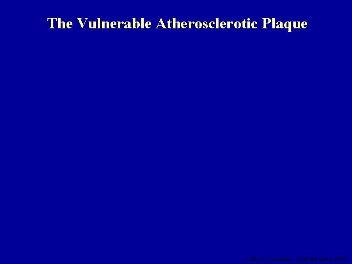 The Vulnerable Atherosclerotic Plaque Libby P. Circulation 1995; 91: 2844 -2850. 