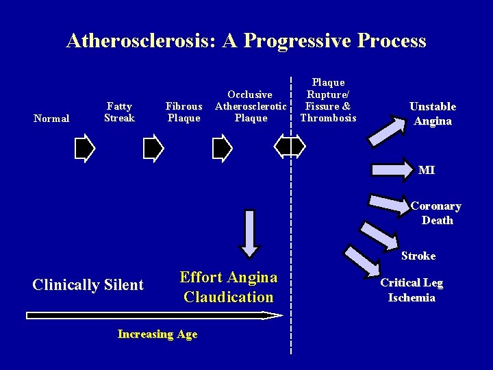 Atherosclerosis: A Progressive Process Normal Fatty Streak Fibrous Plaque Occlusive Atherosclerotic Plaque Rupture/ Fissure