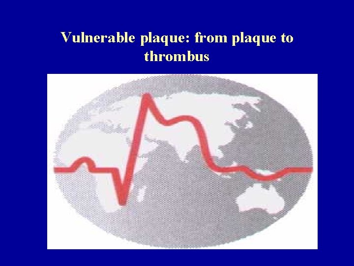 Vulnerable plaque: from plaque to thrombus 