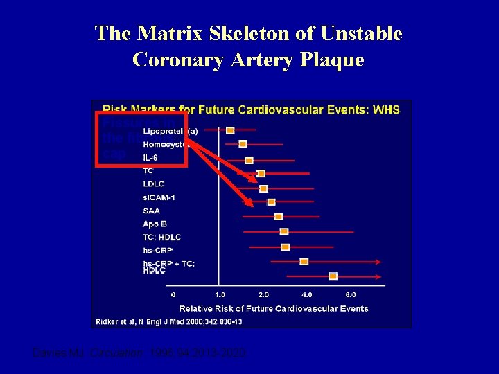 The Matrix Skeleton of Unstable Coronary Artery Plaque Fissures in the fibrous cap Davies