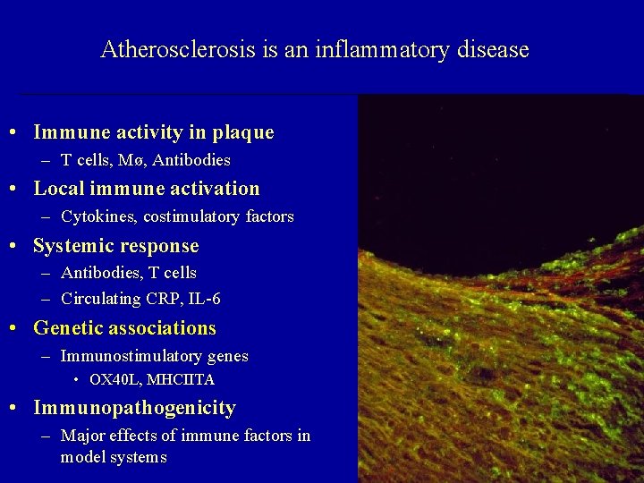 Atherosclerosis is an inflammatory disease • Immune activity in plaque – T cells, Mø,