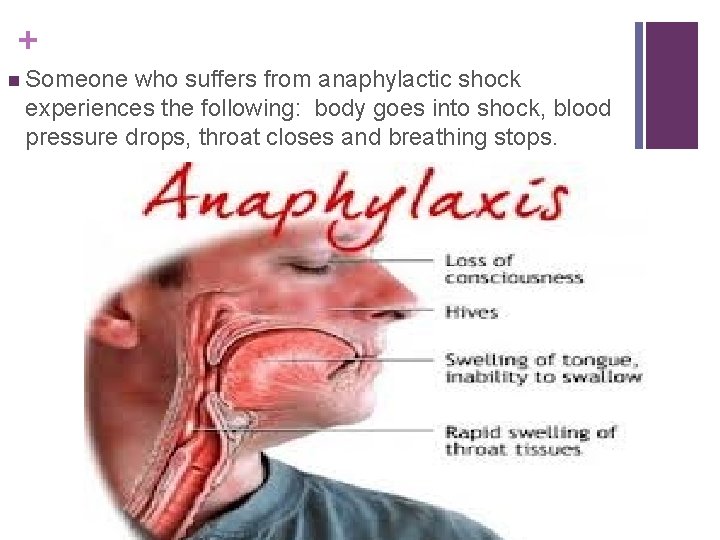 + n Someone who suffers from anaphylactic shock experiences the following: body goes into