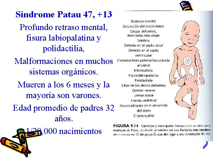 Síndrome Patau 47, +13 Profundo retraso mental, fisura labiopalatina y polidactilia, Malformaciones en muchos