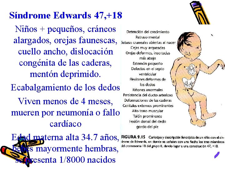 Síndrome Edwards 47, +18 Niños + pequeños, cráneos alargados, orejas faunescas, cuello ancho, dislocación