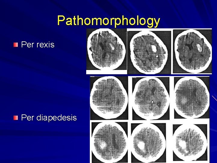 Pathomorphology Per rexis Per diapedesis 