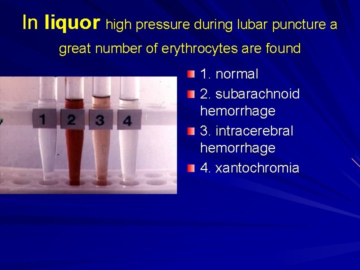 In liquor high pressure during lubar puncture a great number of erythrocytes are found