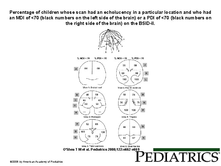 Percentage of children whose scan had an echolucency in a particular location and who