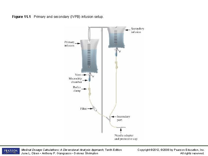Figure 11. 1 Primary and secondary (IVPB) infusion setup. Medical Dosage Calculations: A Dimensional