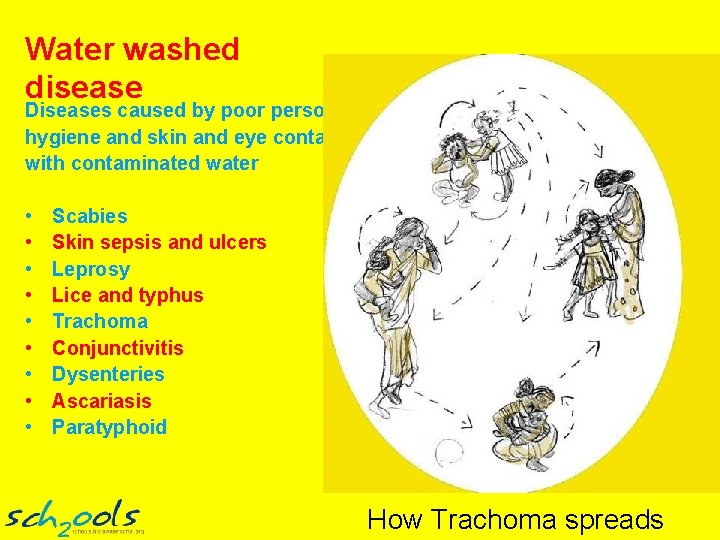 Water washed disease Diseases caused by poor personal hygiene and skin and eye contact