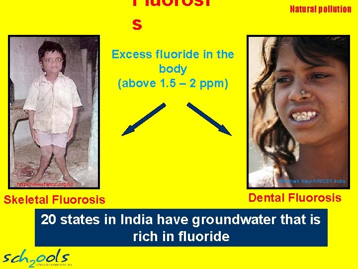 Fluorosi s Natural pollution Excess fluoride in the body (above 1. 5 – 2