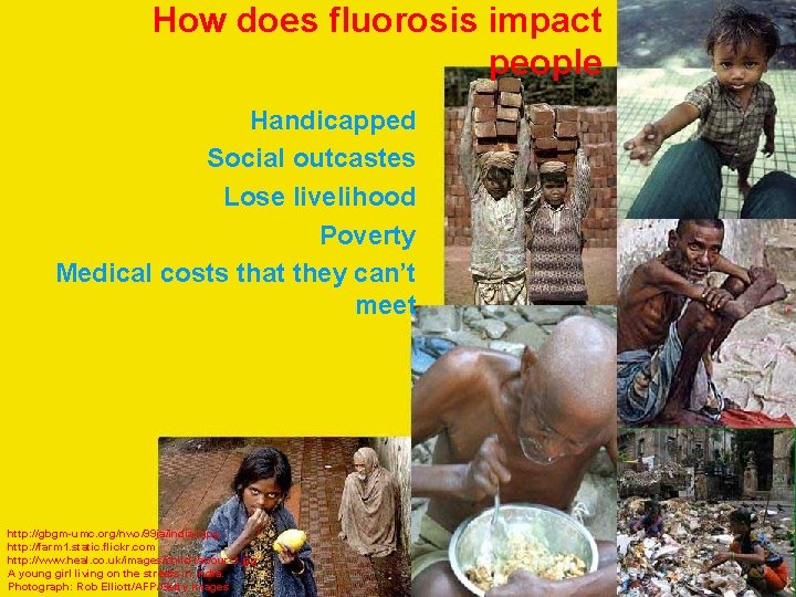 How does fluorosis impact people Handicapped Social outcastes Lose livelihood Poverty Medical costs that