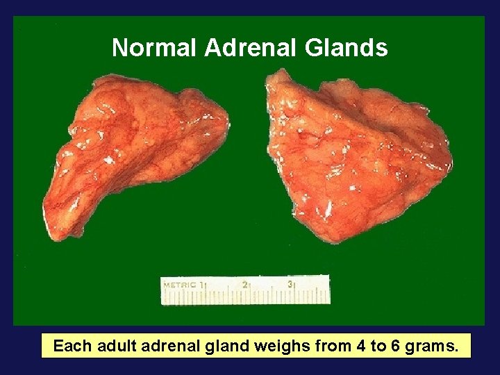 Normal Adrenal Glands Each adult adrenal gland weighs from 4 to 6 grams. 