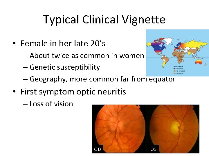 Typical Clinical Vignette • Female in her late 20’s – About twice as common
