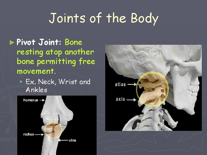 Joints of the Body ► Pivot Joint: Bone resting atop another bone permitting free