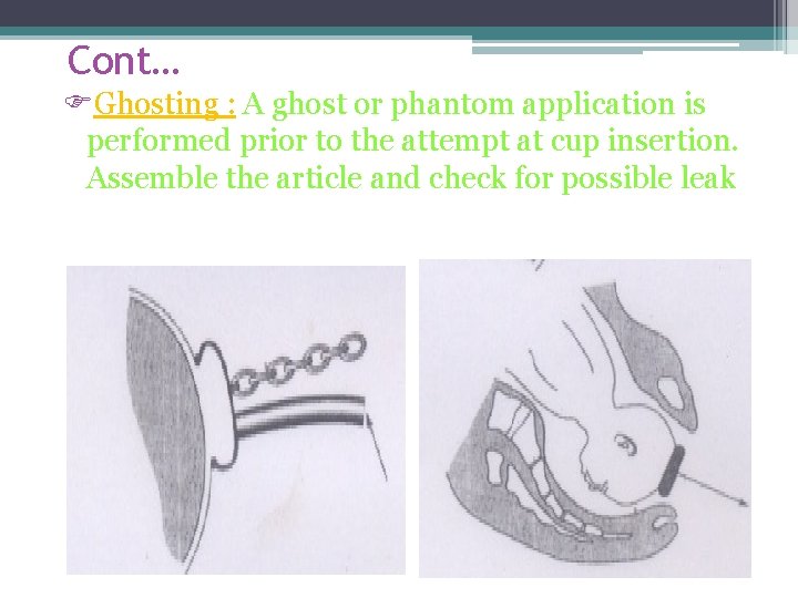 Cont… Ghosting : A ghost or phantom application is performed prior to the attempt