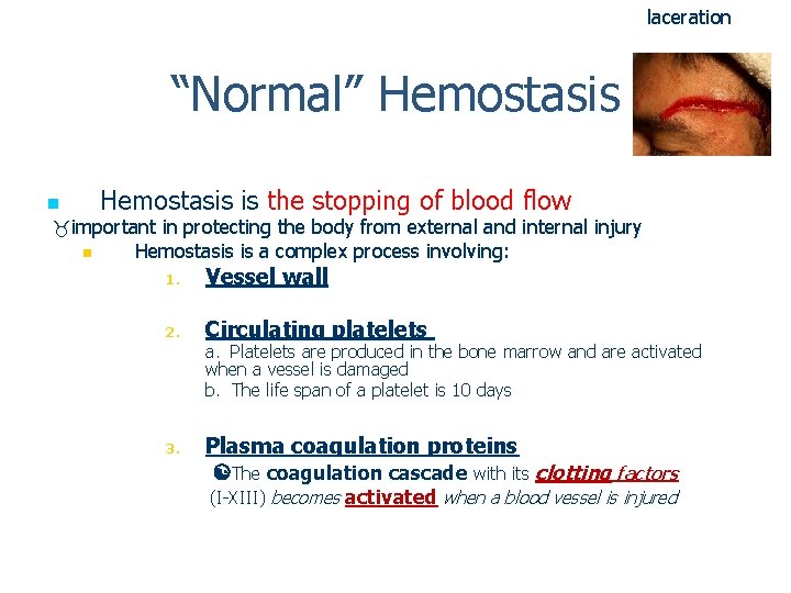 laceration “Normal” Hemostasis n Hemostasis is the stopping of blood flow important in protecting