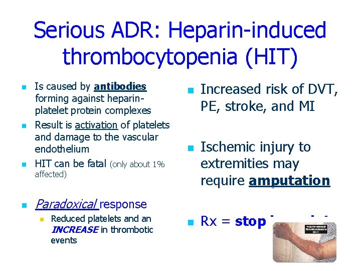 Serious ADR: Heparin-induced thrombocytopenia (HIT) n n n Is caused by antibodies forming against
