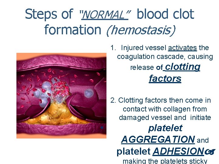 Steps of “NORMAL” blood clot formation (hemostasis) 1. Injured vessel activates the coagulation cascade,