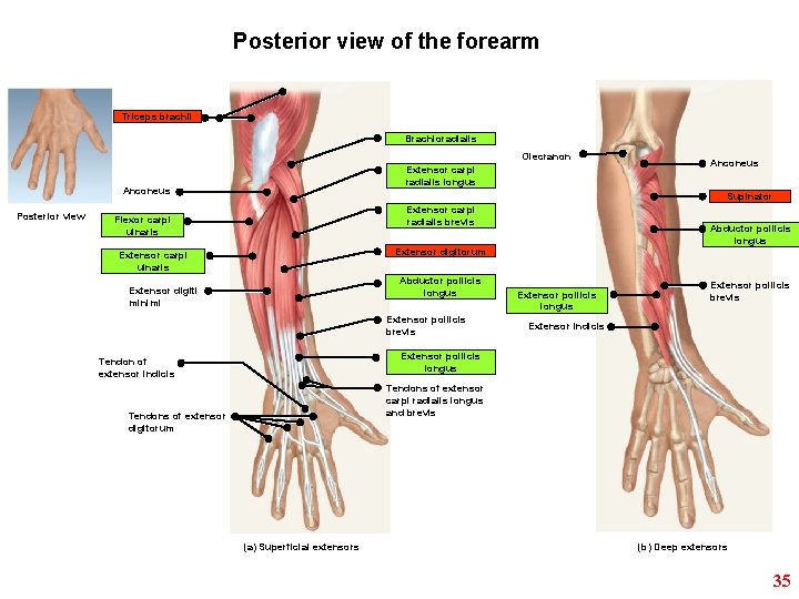 Posterior view of the forearm Triceps brachii Brachioradialis Olecranon Extensor carpi radialis longus Anconeus