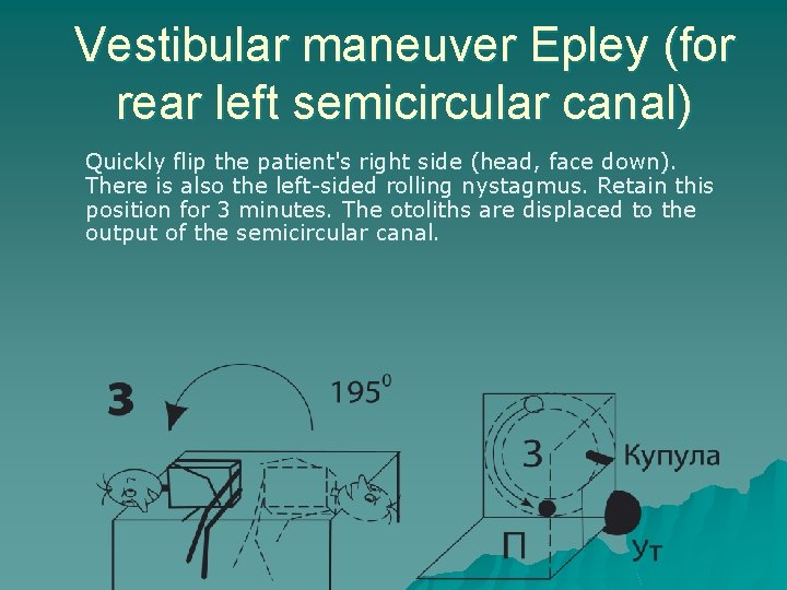 Vestibular maneuver Epley (for rear left semicircular canal) Quickly flip the patient's right side