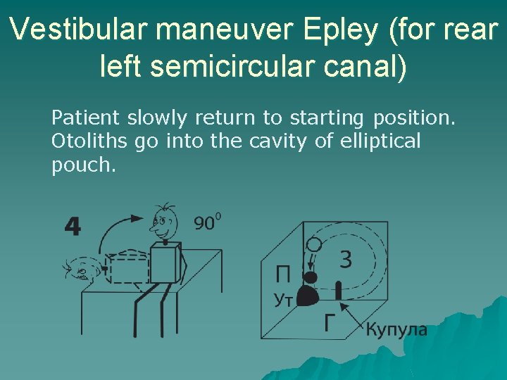 Vestibular maneuver Epley (for rear left semicircular canal) Patient slowly return to starting position.