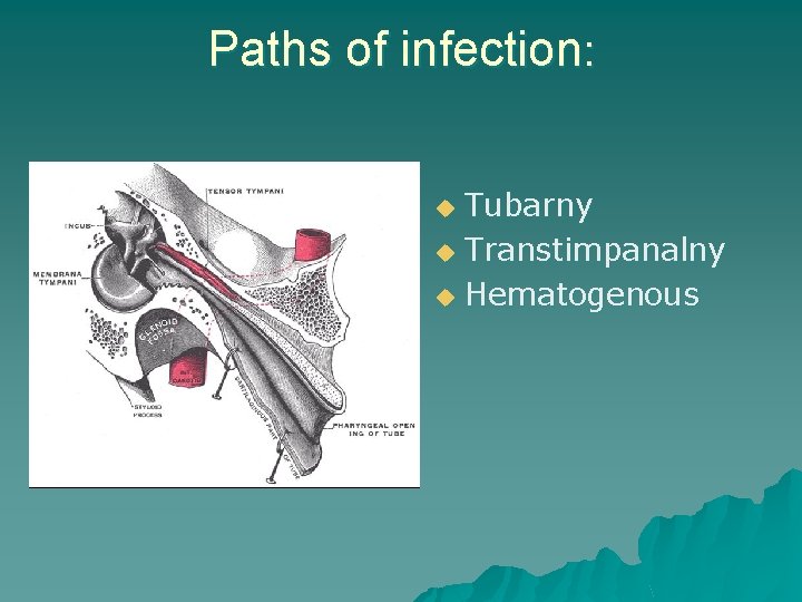 Paths of infection: Tubarny u Transtimpanalny u Hematogenous u 