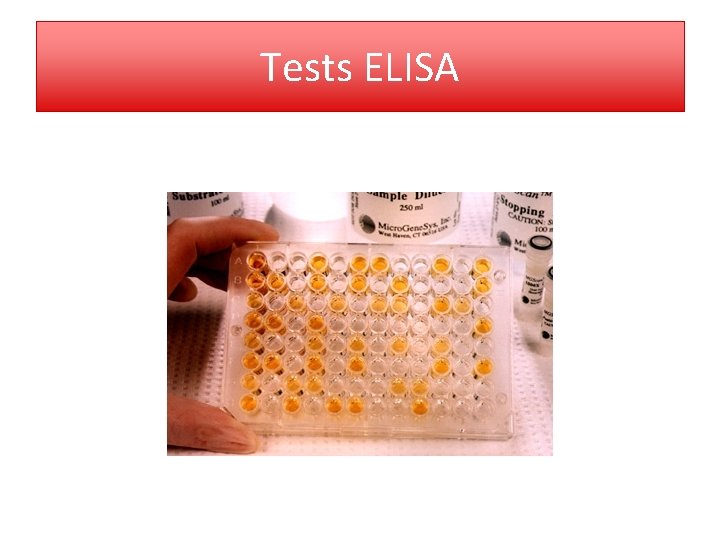 Tests ELISA 