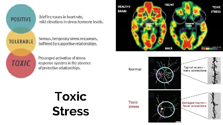 Toxic Stress 