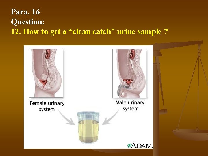 Para. 16 Question: 12. How to get a “clean catch” urine sample ? 