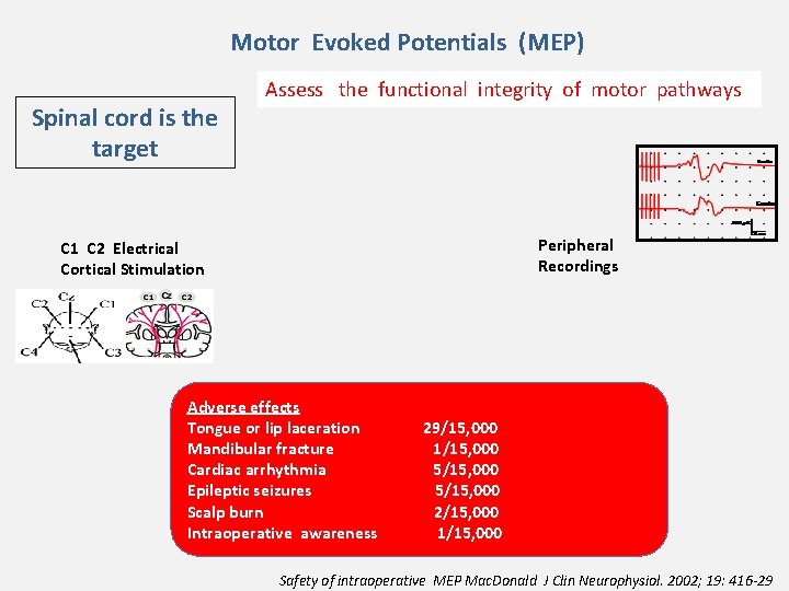 Motor Evoked Potentials (MEP) Spinal cord is the target Assess the functional integrity of