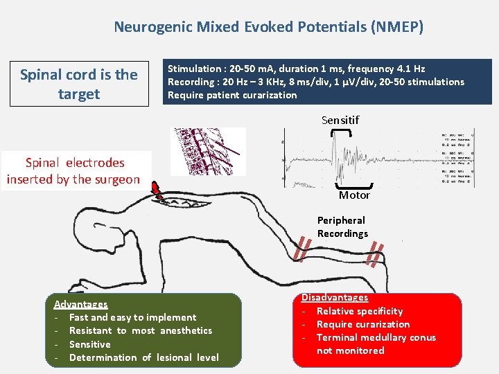 Neurogenic Mixed Evoked Potentials (NMEP) Spinal cord is the target Stimulation : 20 -50