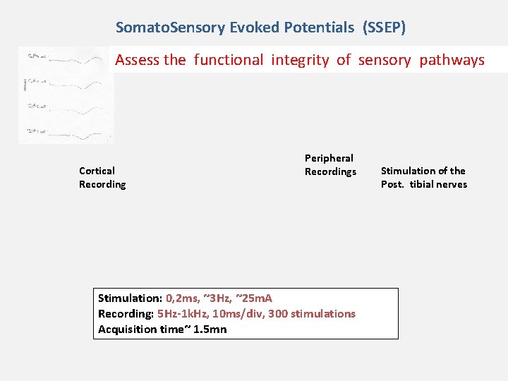 Somato. Sensory Evoked Potentials (SSEP) Assess the functional integrity of sensory pathways Cortical Recording