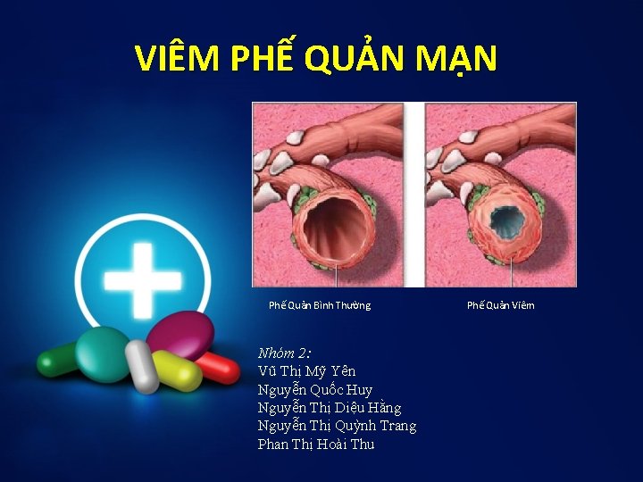 VIÊM PHẾ QUẢN MẠN Phế Quản Bình Thường Nhóm 2: Vũ Thị Mỹ Yên