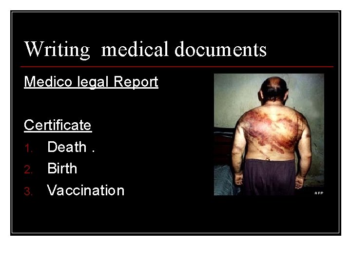 Writing medical documents Medico legal Report Certificate 1. Death. 2. Birth 3. Vaccination 