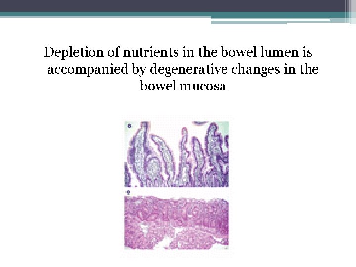 Depletion of nutrients in the bowel lumen is accompanied by degenerative changes in the