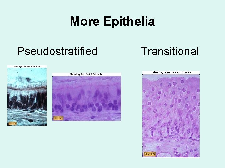 More Epithelia Pseudostratified Transitional 