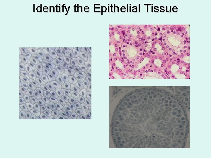 Identify the Epithelial Tissue 