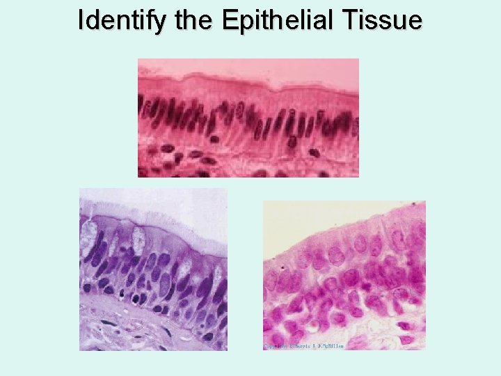 Identify the Epithelial Tissue 