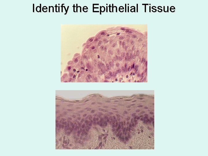 Identify the Epithelial Tissue 