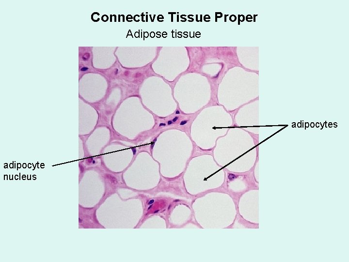 Connective Tissue Proper Adipose tissue adipocytes adipocyte nucleus 