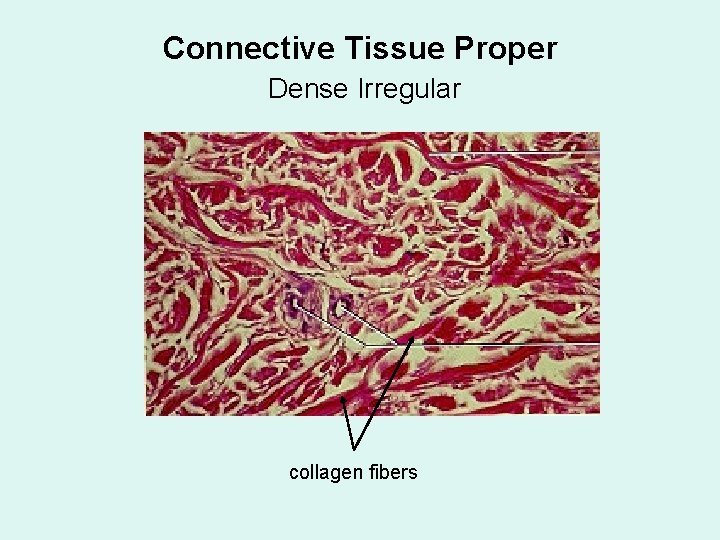 Connective Tissue Proper Dense Irregular collagen fibers 