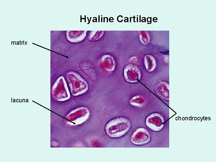 Hyaline Cartilage matrix lacuna chondrocytes 