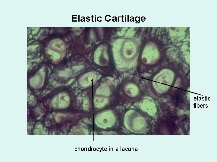 Elastic Cartilage elastic fibers chondrocyte in a lacuna 
