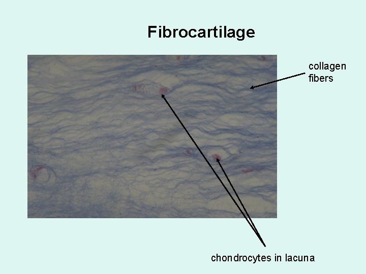 Fibrocartilage collagen fibers chondrocytes in lacuna 
