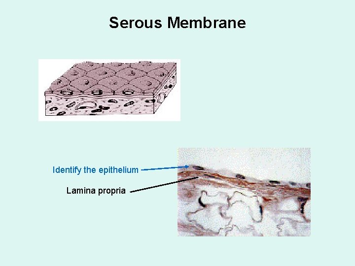 Serous Membrane Identify the epithelium Lamina propria 