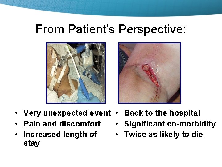 From Patient’s Perspective: • Very unexpected event • Back to the hospital • Pain