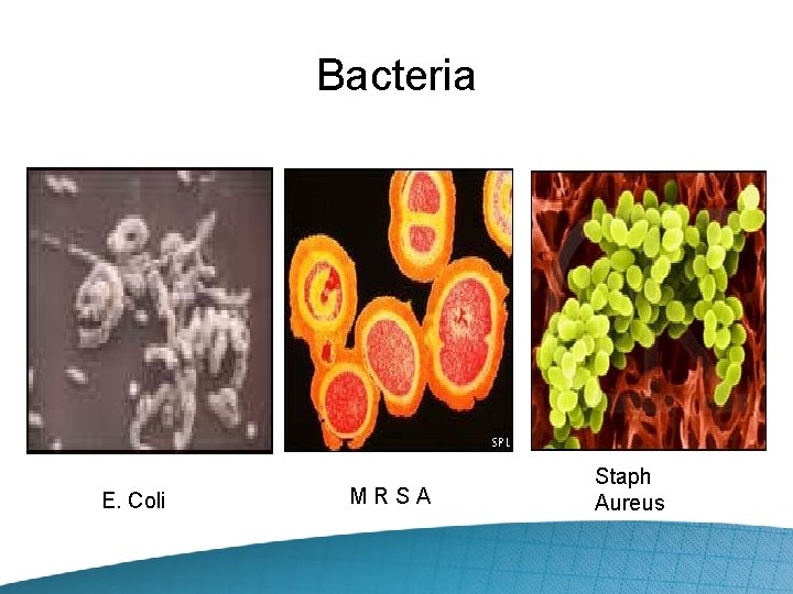 Bacteria E. Coli MRSA Staph Aureus 